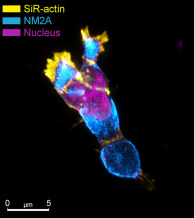 Fluorescence microscopy revealing cortical actin and a segmented T cell nucleus